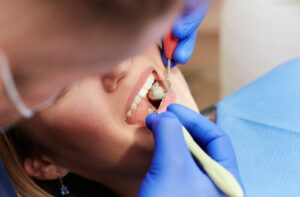 Dentist checking for cavities of a female client