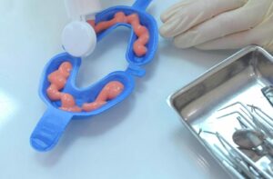 A disposable fluoride tray is being filled before use.