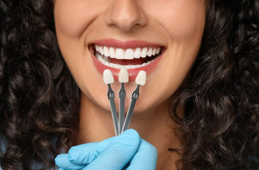 A woman comparing colours for her new dental veneers.
